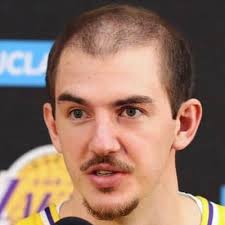 We sat down with alex caruso to talk about his path from going undrafted to being a key rotation player for the most basketball fans probably hadn't heard of alex caruso until they saw him do this Alex Caruso S Receding Hairline Alexhairline Twitter