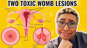 Abnormal Cervical Appearance: what to do, when to worry?