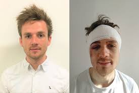 Man left unconscious after another phone snatch attack