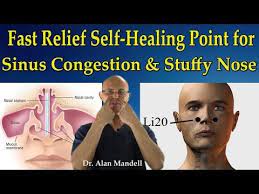 Fast Relief Self Healing Point For Sinus Congestion Stuffy Nose Headaches Dr Mandell Youtube Sinus Allergies Sinus Pressure Relief Sinus Drainage