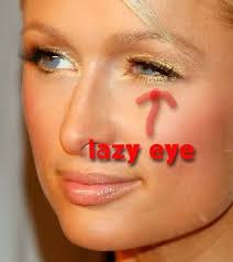 We did not find results for: Can Movies Cure Lazy Eye Siowfa16 Science In Our World Certainty And Controversy