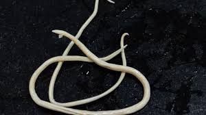 Image result for Pinworm