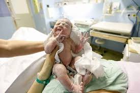 Bei den meisten babys fällt er innerhalb der ersten zehn lebenstage ab. Die Nabelschnur Lebenswichtige Verbindung Zwischen Mutter Und Kind