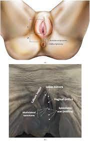 Diagnostics Free Full Text Midline And Mediolateral Episiotomy Risk Assessment Based On Clinical Anatomy Html