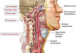 Image result for carotid artery