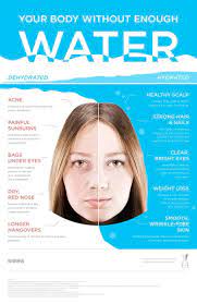 Its Alll About Water How To Stay Healthy Health Tips Body Health