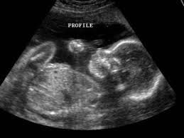 Image result for ultra sound