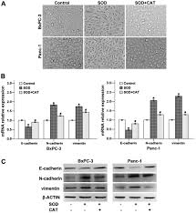 Pancreatic cancer is more common among older cats, suggesting it may. Superoxide Dismutase Promotes The Epithelial Mesenchymal Transition Of Pancreatic Cancer Cells Via Activation Of The H2o2 Erk Nf Kb Axis