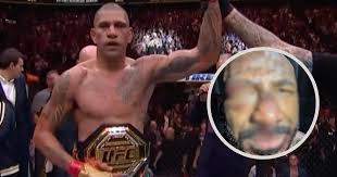 Zmasakrowana twarz Khalila Rountree Jr. po przegranej z Alexem Pereirą na  UFC 307