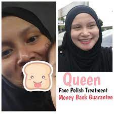 Assalammualaikum and hello all… adakah muke anda kusam teruk? Queen Face Polish Treatment Queen Face Polish Malaysia
