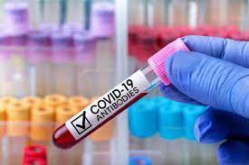 Mit vizsgál a laboratóriumi antitest teszt? Koronavirus Ez A Teszt Mutatja Ki Hogy Mennyi Antitestje Van Oltas Utan Egeszsegkalauz