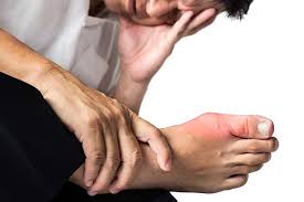 Info unterschied zwischen arthrose und arthritis im deutschen wird im gegensatz zu anderen sprachen (z. Erhohte Gichtgefahr Wahrend Einer Low Carb Diat Gicht Risiko Senken