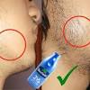 The facial hair growth is also dependent on the cleanliness and hygiene of the face. 1