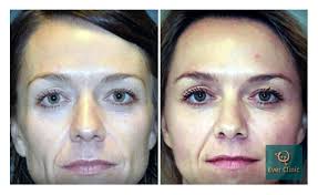 We did not find results for: Facelift Glasgow Ever Clinic Voted Best Clinic In Scotland 2019