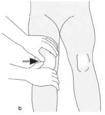 Image result for Patella Mobility Test