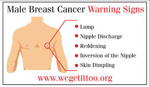 Swollen itchy male breast cancer or not? Jordana Phillips On Twitter 17 Key Take Home Points Any Man Can Get Cancer But There Are Certain People That Are At Increased Risk Know Your Breasts Go See Your Doctor If