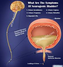 What Are The Symptoms Of Neurogenic Bladder Bladder Incontinence Overactive Bladder Remedies Endometriosis Symptoms