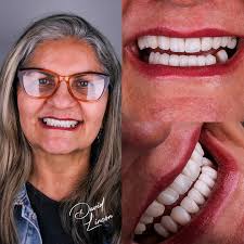 Dr. David Lincon (@dr.david_lincon) • Instagram photos and videos