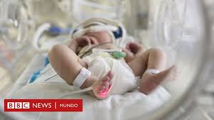 Maybe you would like to learn more about one of these? Coronavirus En Brasil Por Que Mueren 10 Veces Mas Bebes Por Covid 19 En El Pais Sudamericano Que En Estados Unidos Bbc News Mundo