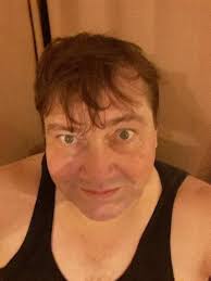 Recovering from rotator cuff surgery