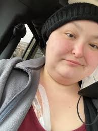 Starting TCM treatment today