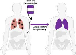 Learn how cancer spreads, possible symptoms, common sites where cancer spreads, and how to find out about treatment options. Colorectal Cancer Lung Metastasis Treatment With Polymer Drug Nanoparticles Sciencedirect