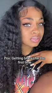 PAIN! #jehvanaj #fyp #fypシ #braces