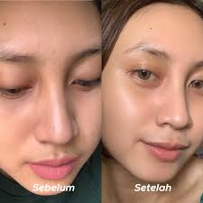 Perawatan kulit wajah