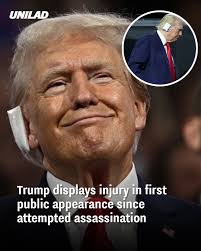 The bullet pierced the upper part of his right ear.