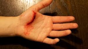 Special Effects Tutorial How To Make A Realistic Cut In Hand Part 2 Youtube