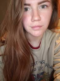 Does your skin look like this? Here's what to do about it 👇 Enjoy 15% off  my SLMD moisturizers using code GLOWON15 for a limited time.