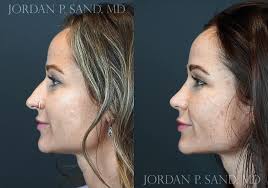 Jordan P. Sand, M.D., F.A.C.S.