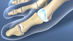Image result for Metatarsal