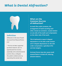 Image result for Tooth Abrasion