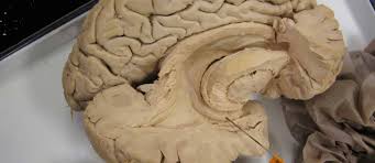 Image result for Amnesic Shellfish Poisoning