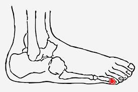 Pressure Points On Feet To Start Labor Pressure Points For