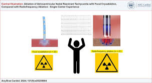 Ablation of Atrioventricular Nodal Reentrant Tachycardia with Focal  Cryoablation, Compared with Radiofrequency Ablation: Single-Center  Experience - ABC Cardiol