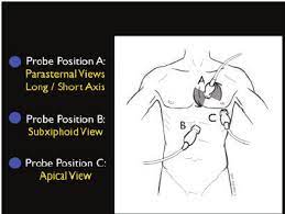 Rush exam=rapid ultrasound for shock and hypotension. The Rush Exam Step 1 Evaluation Of The Pump Download Scientific Diagram