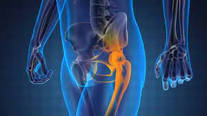 prostate cancer is the most common cancer in men after skin cancer. Bromium Materia Medica Reversed Kent S Repertory Prostate Cancer Abdominal Swelling
