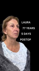 What Surgery Did Laura Get