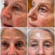 Elite Aesthetics by Natalie