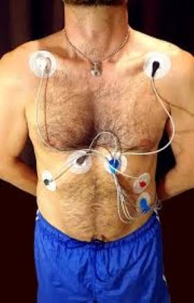 Holter Monitoring product image