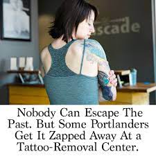 Past methods of removal left scars, required surgery, were painful and/or ineffective. L00btll4qhqp4m