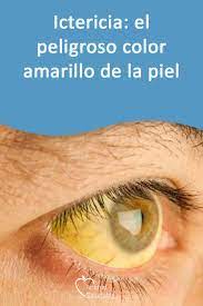 Pin En Piel
