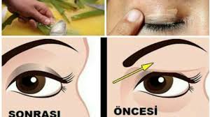 Goz Kapagi Dusuklugu Dogal Tedavisi Youtube Dusuk Gozler Cilt Bakimi Dogal Cilt