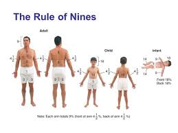 Rule Of Nines Flashcards Quizlet