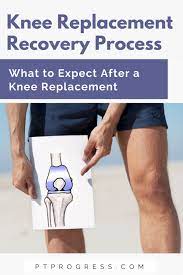 Read about knee replacement surgery (arthroplasty), a procedure to replace a damaged, worn or diseased knee with an artificial joint. Total Knee Replacement Recovery What To Expect After Knee Replacement