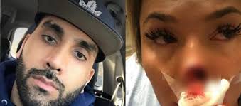 Hombre le arranca la nariz a su novia por terminar con él