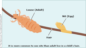 How many head lice are usually found on an infested person? Head Lice For Parents Nemours Kidshealth