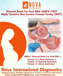 Non Invasive Prenatal Testing Nipt Prenatal Testing Nipt Prenatal